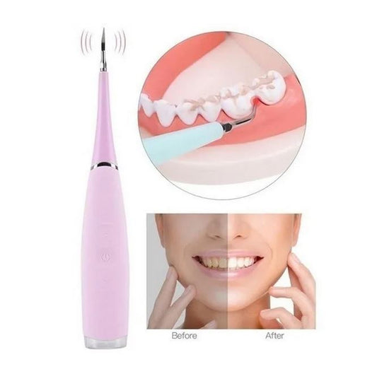 Limpiador De Dientes Eléctrico Removedor Sarro