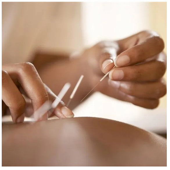 Agujas Desechables Para Acupuntura Esteriles 500 U Aplicador